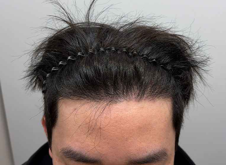 앞(후).png