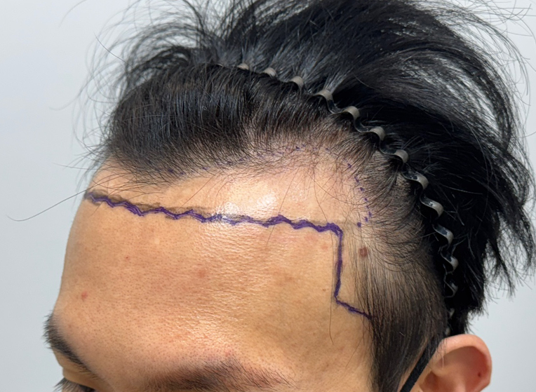 옆(전).png