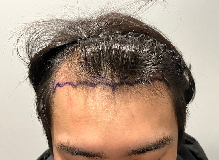 앞(전).png