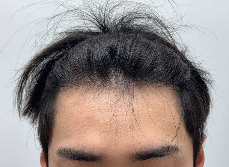 앞(후).png