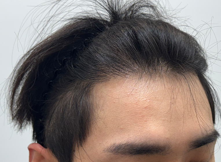 옆(후).png