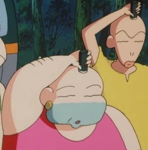 모발이식 대다모.JPG