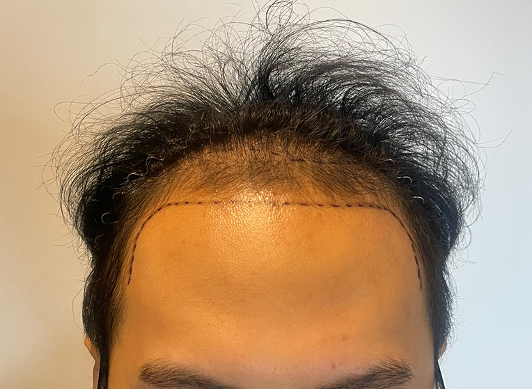 앞(전).png