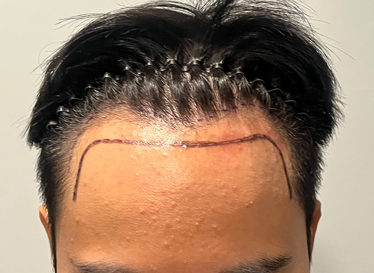앞(전).png