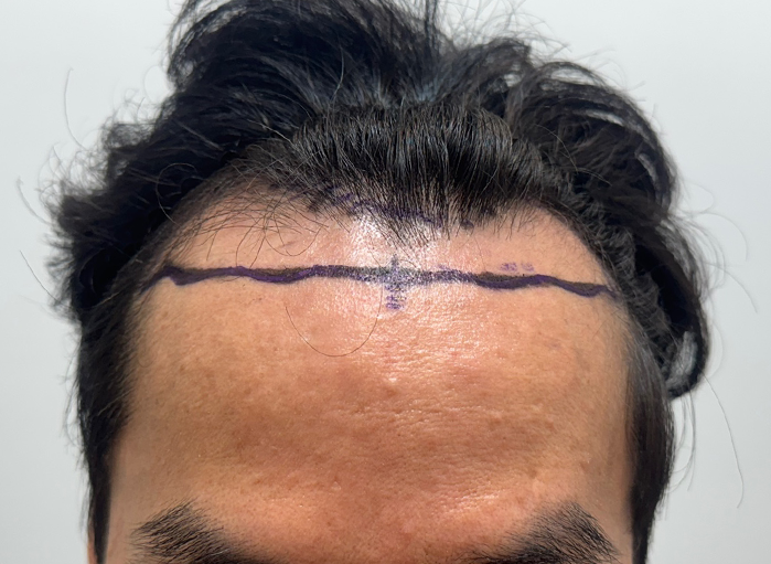앞(전).png