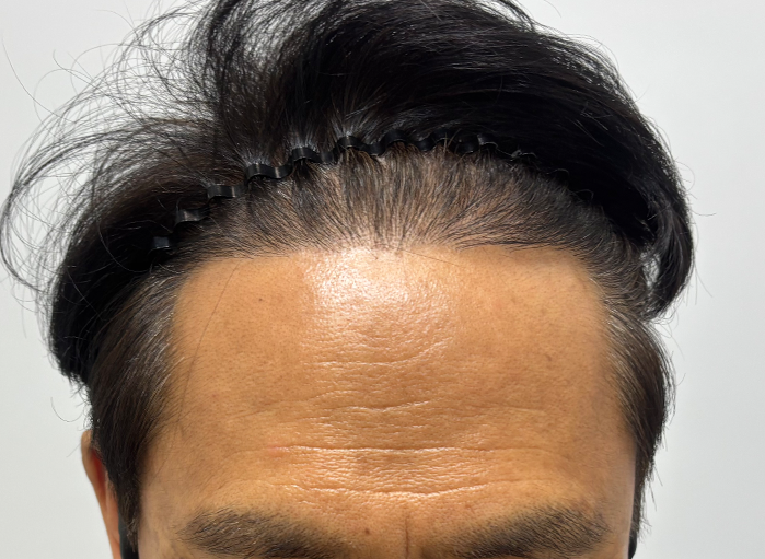 앞(후).png