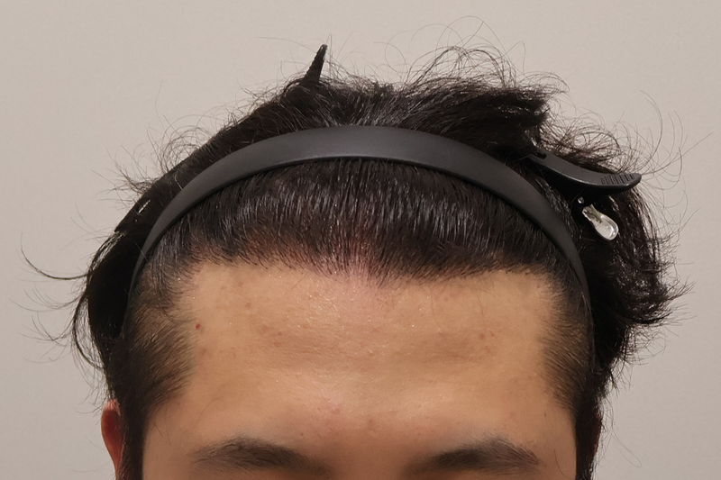 1.png