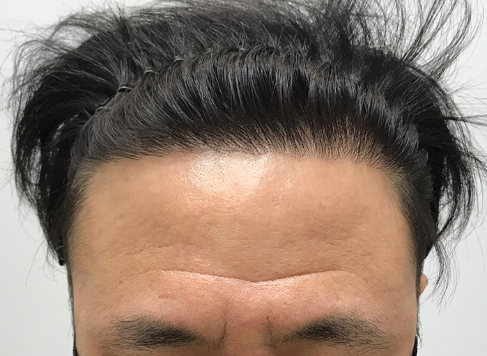 앞(후).png