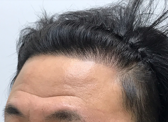 옆(후).png