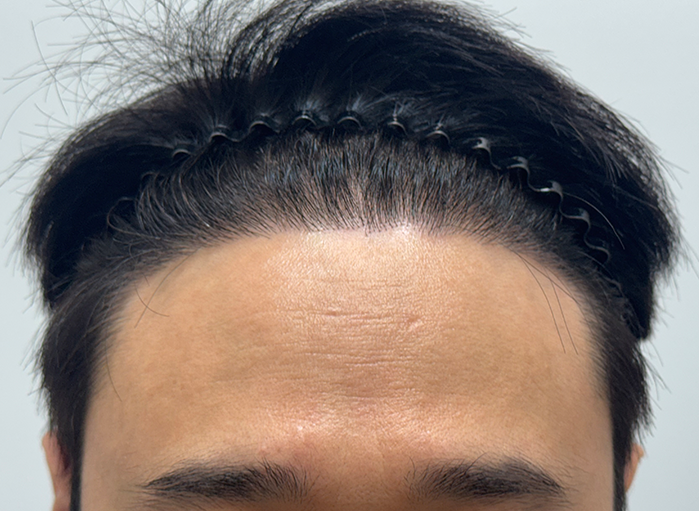 앞(후).png