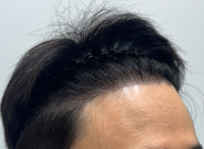 옆(후).png