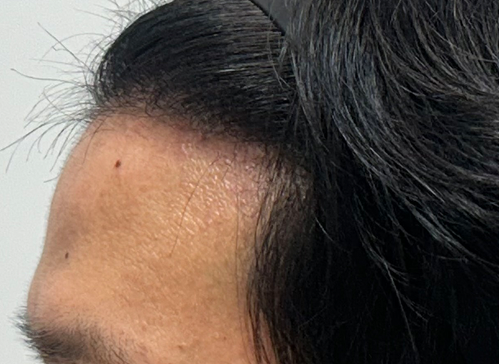 옆(후).png