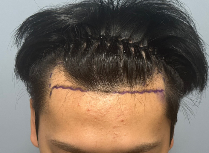 앞(전).png