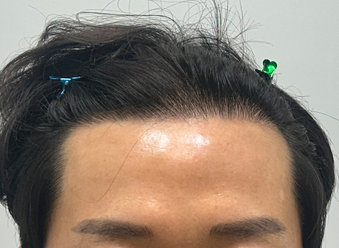 앞(후).png