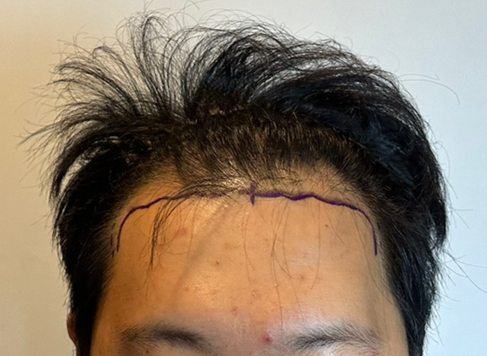 앞(전).png