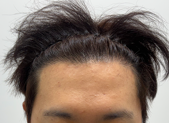 앞(후).png