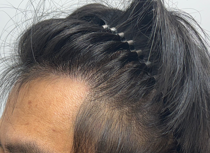 옆(후).png