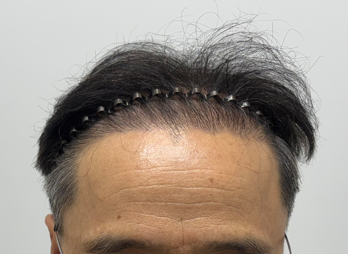 앞(후).png