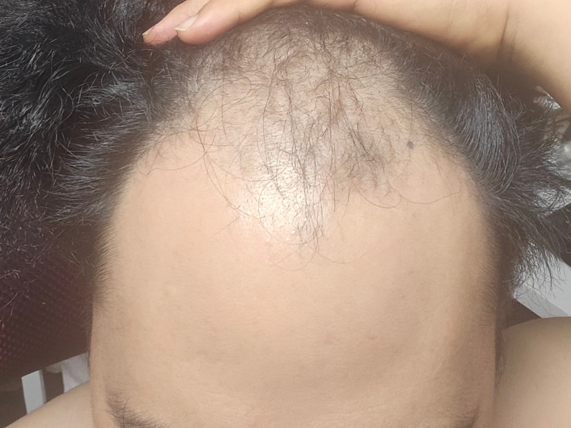 11일후에는 어떤 모습일까?