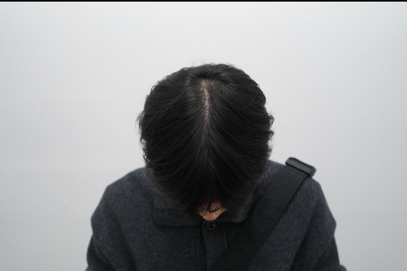 정수리 (앞)