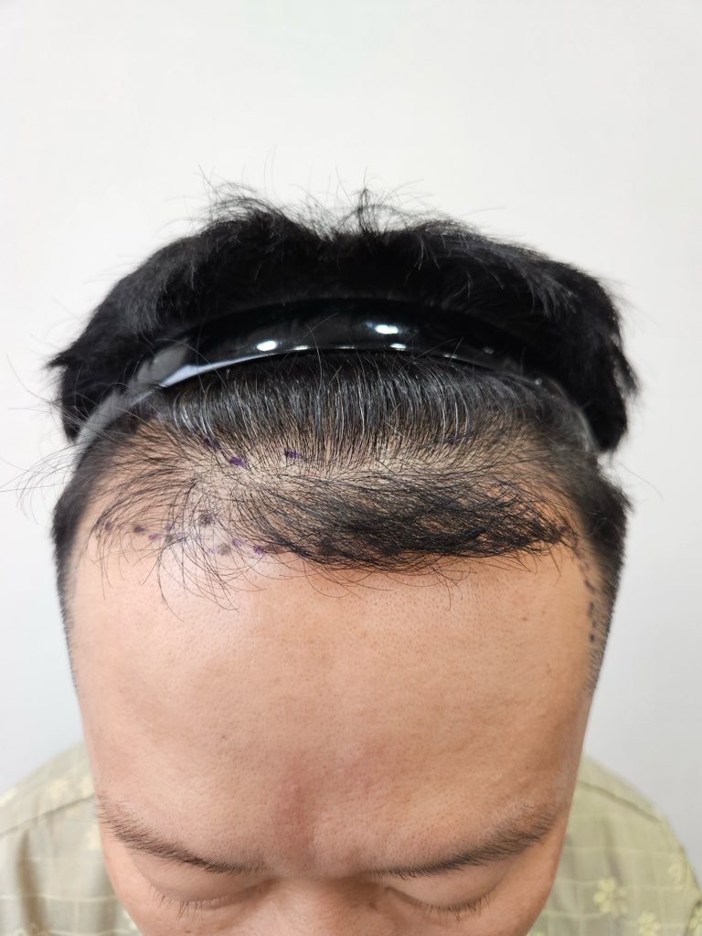 1000009285.jpg