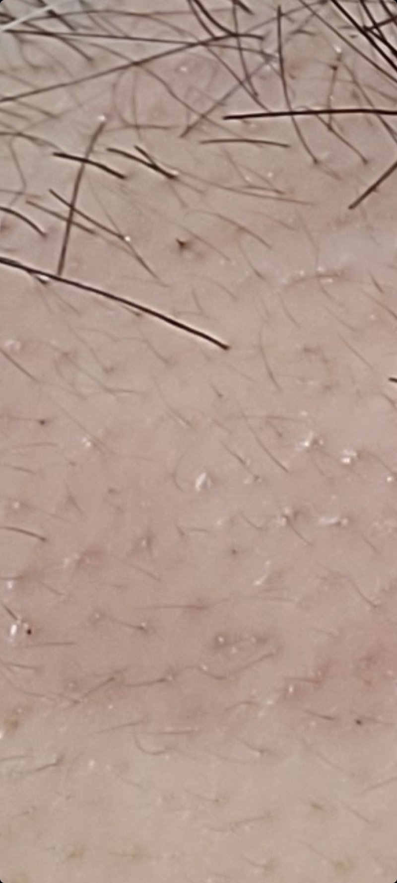 Screenshot_20210715-201331_Gallery.jpg