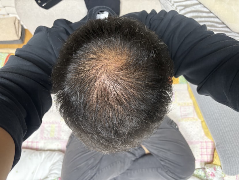 9개월