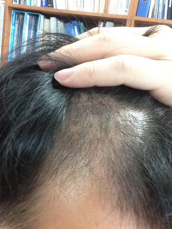 KakaoTalk_20170707_120530843.jpg