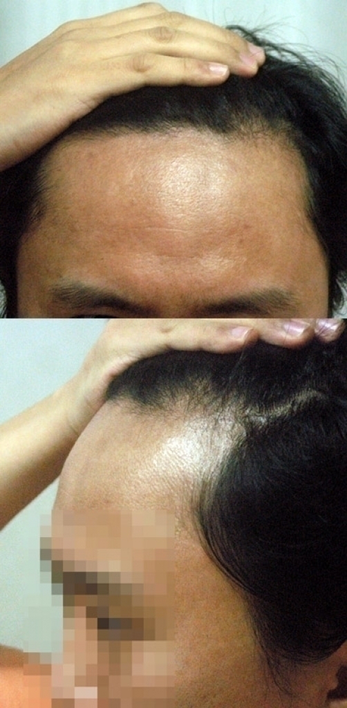 before.jpg