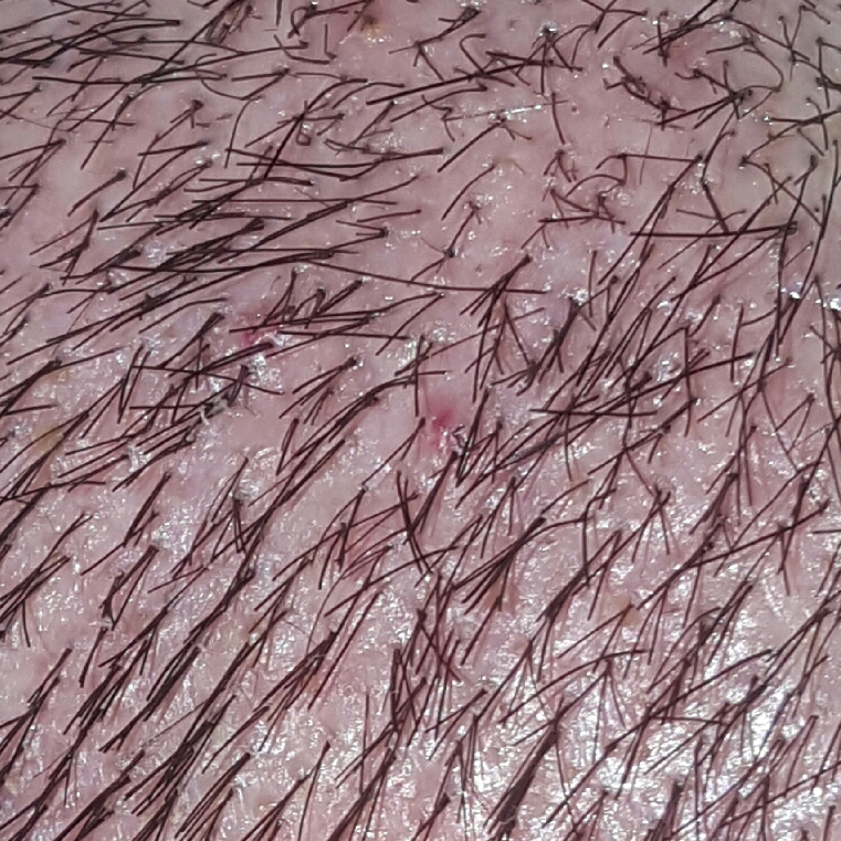 20170106_182927.jpg