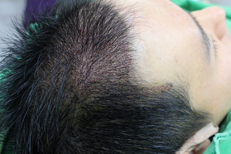 양 영선_20160328_모발_16886.jpg