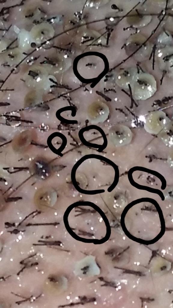 20180223_204247.png