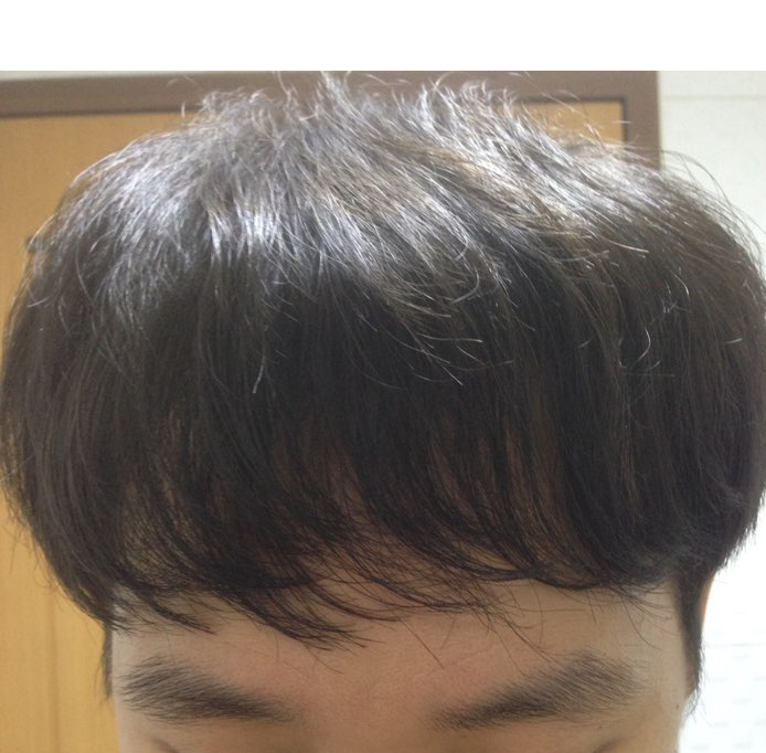 머리.png