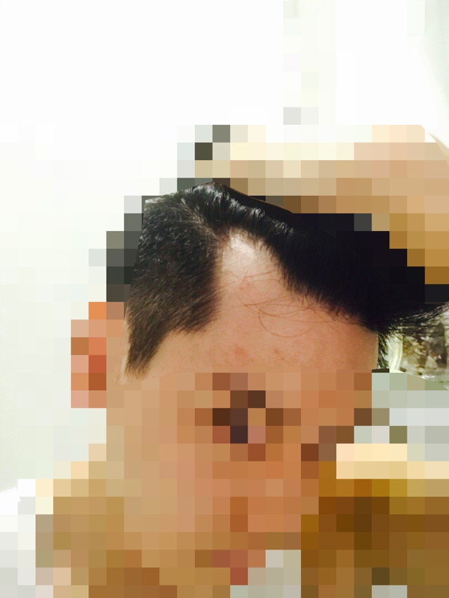 857263C8-2B8C-4313-9001-47B41B828AAC.png