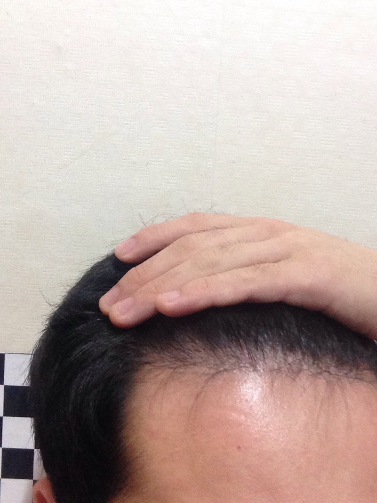 S__4292610.jpg