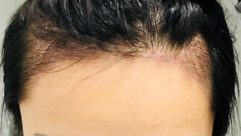 KakaoTalk_20180307_211002999.jpg