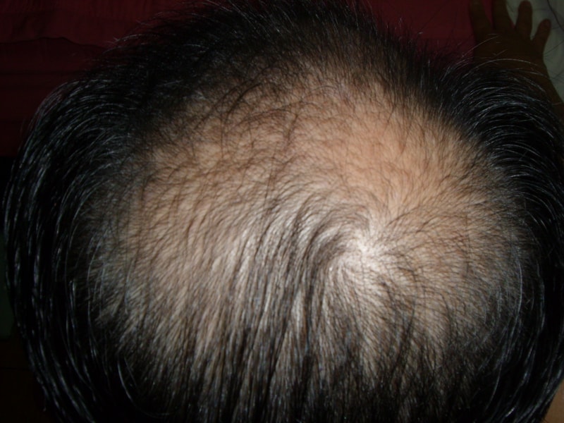 SL703051.JPG