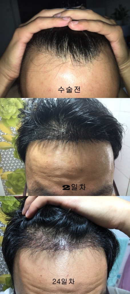 24일차까지.jpg