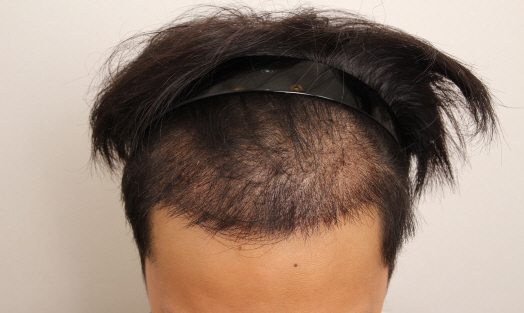 크기변환_10일경과.jpg