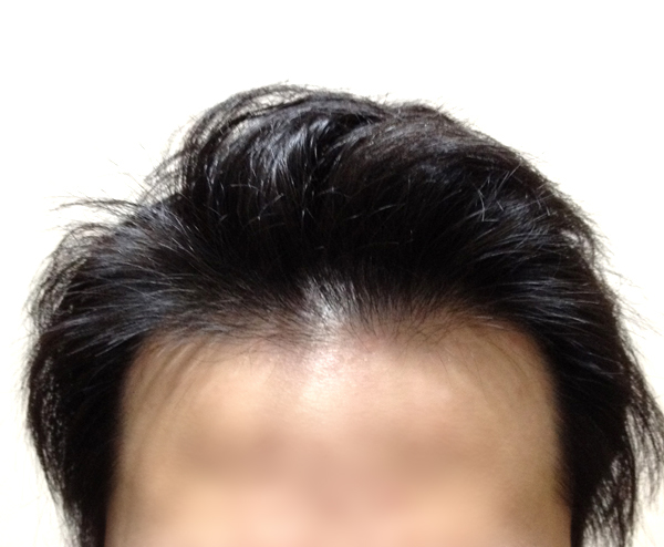 Front.jpg