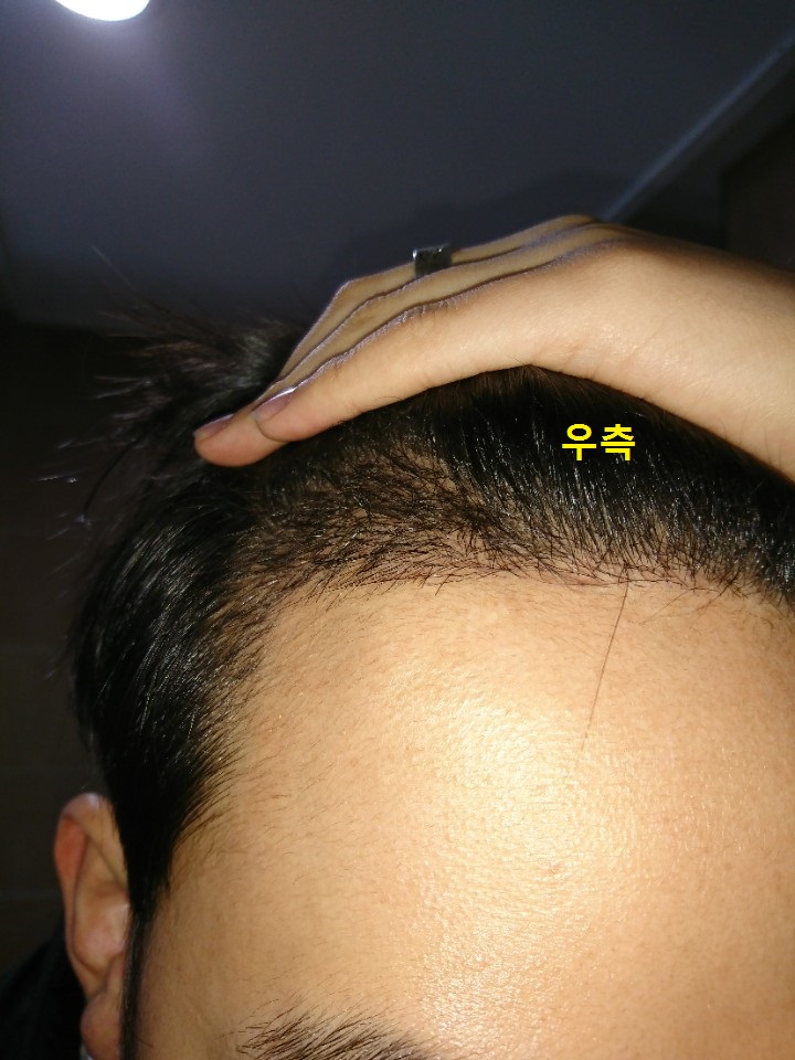 KakaoTalk_20170227_085519182.jpg