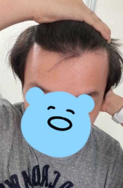 수술전입니다 