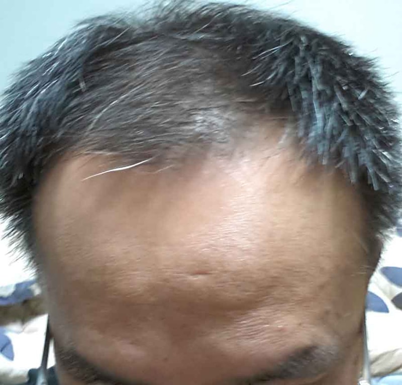 수술전정면1.jpg