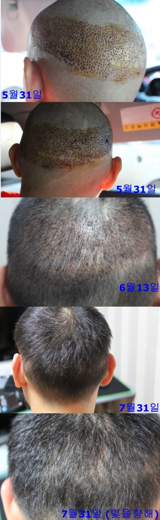 뒤통수 원조.jpg