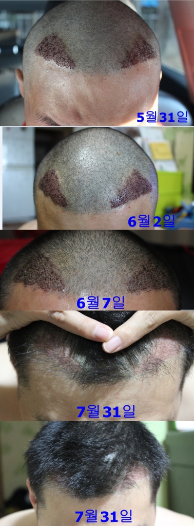 정면 3.jpg