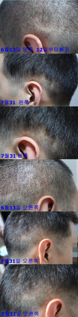 왼쪽 오른쪽 동반탈락1.jpg