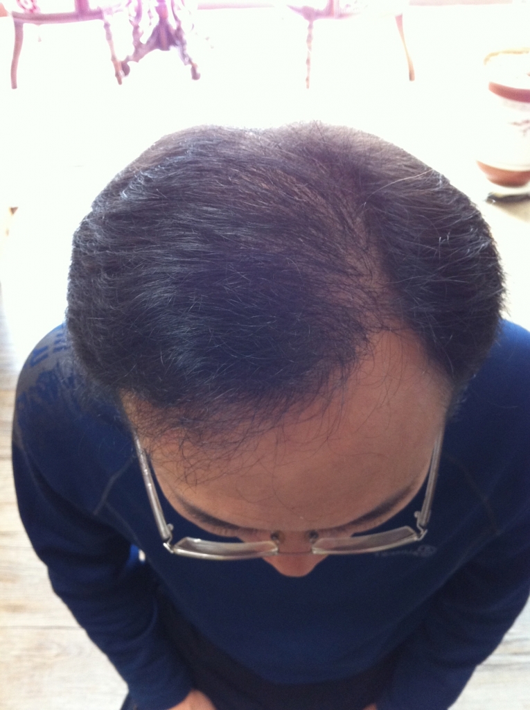 크기변환_이식후310.jpg