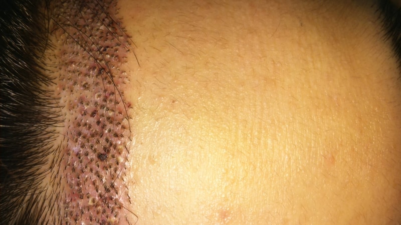20170627_003010.jpg
