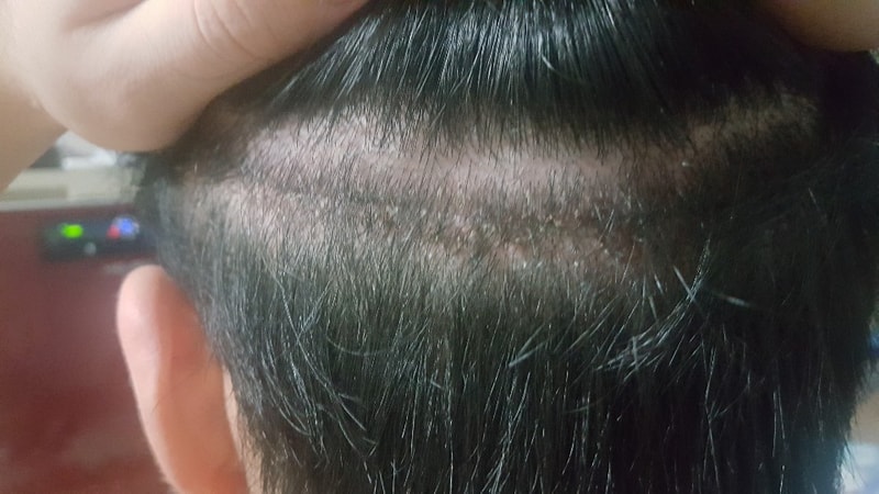 KakaoTalk_Photo_20190318_2141_11115.jpg
