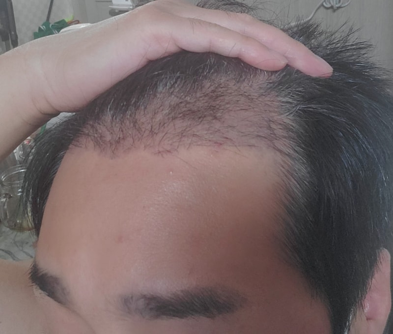 3번.jpg